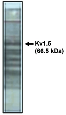 "
Western blot analysis
using Kv1.5 antibody on
rat brain lysate."